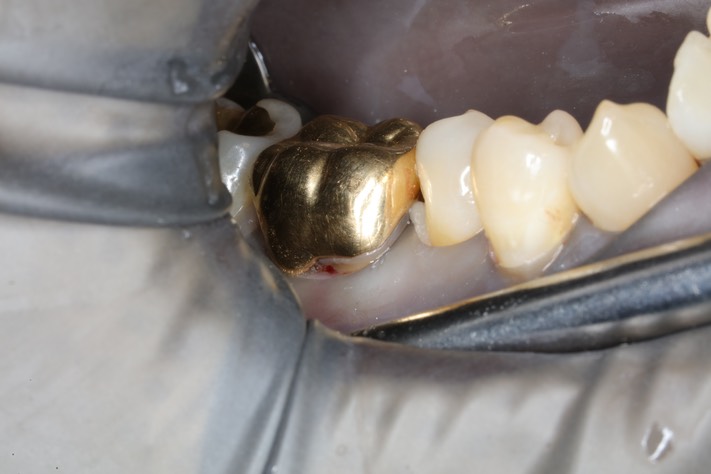 Chris Woo #30 pre-op