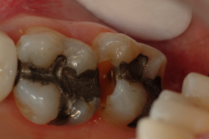 Larry Fujioka #2 pre-op