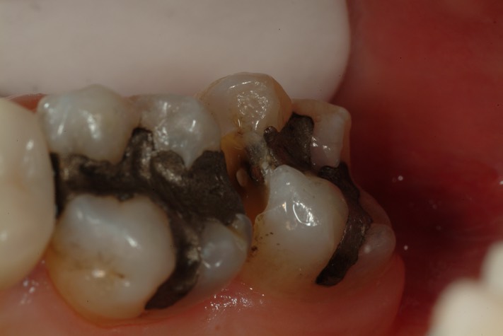 Larry Fujioka #2 pre-op