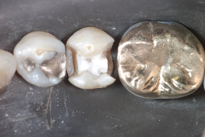 Matt Dodson #20 prep