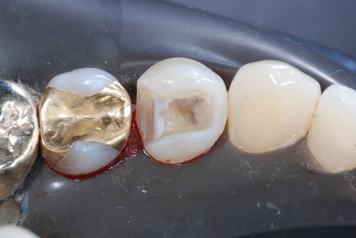 Brandon Yokota #28 prep