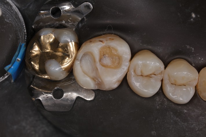 Frank Fukuda #14 prep 2