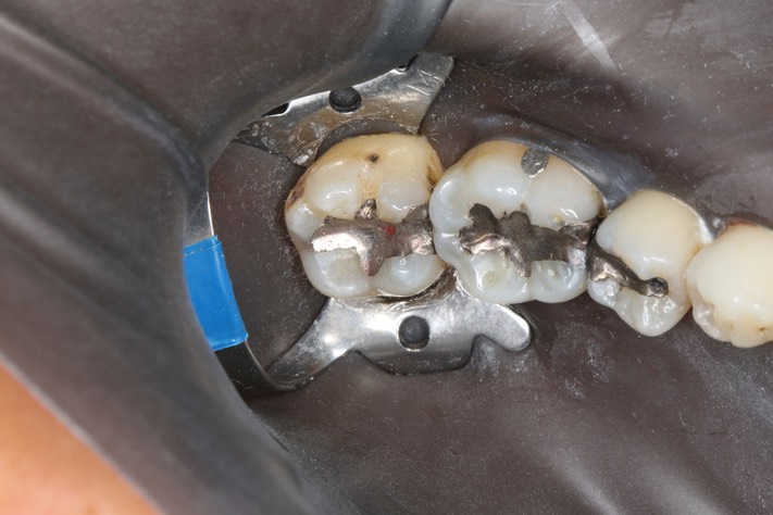 Frank Fukuda #18 pre-op