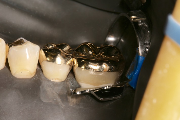 Frank Fukuda #19, 20 finish