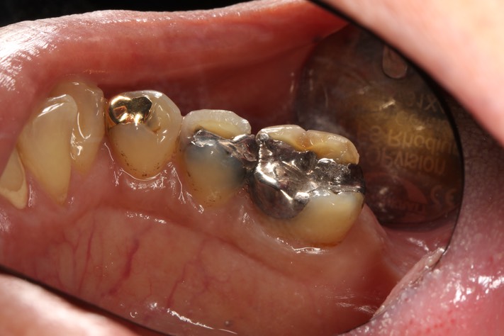 Frank Fukuda #19 pre-op