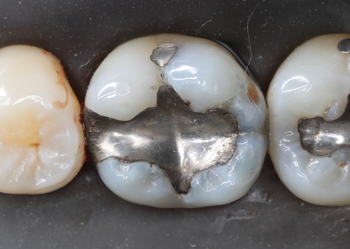 Frank Fukuda #19 pre-op