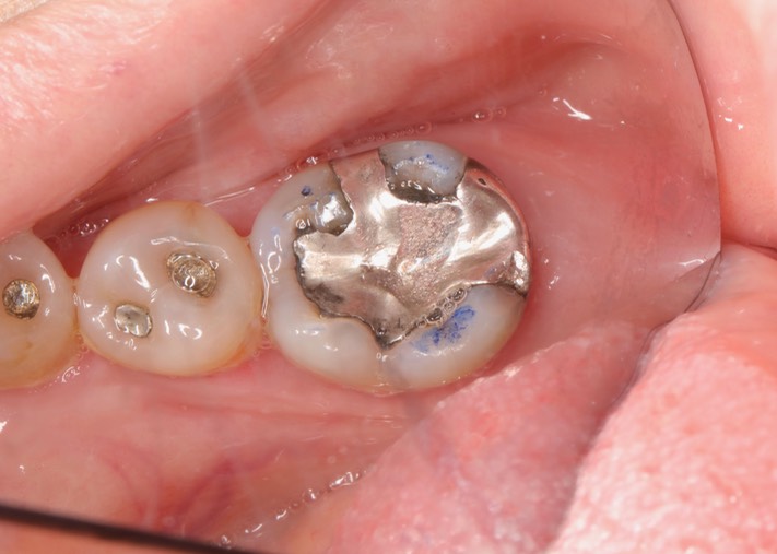 Frank Fukuda #19 pre-op