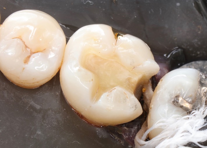 Frank Fukuda #19 prep