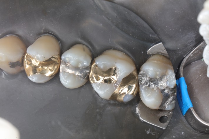 Frank Fukuda #3 finish