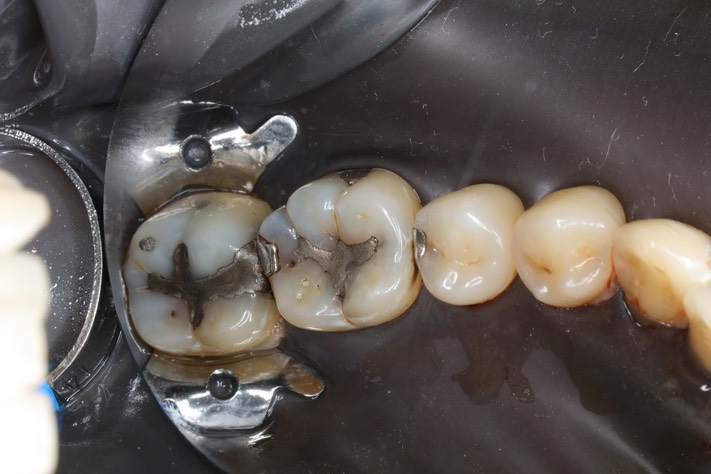 Frank Fukuda #30 pre-op