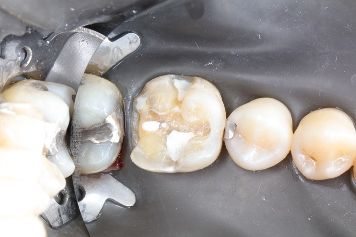 Frank Fukuda #30 prep