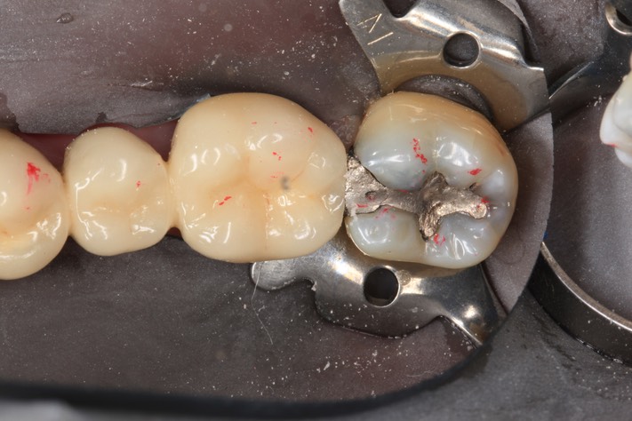 Frank Fukuda #18 pre-op