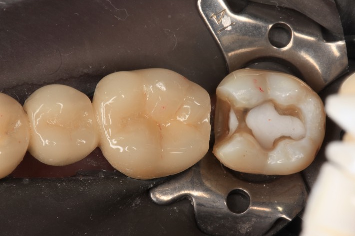 Frank Fukuda #18 prep