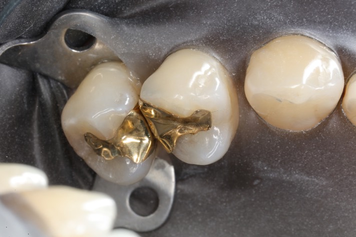 Gary Umeda #12-13 casting try in