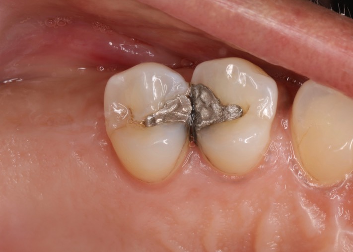 Gary Umeda #12-13 pre-op