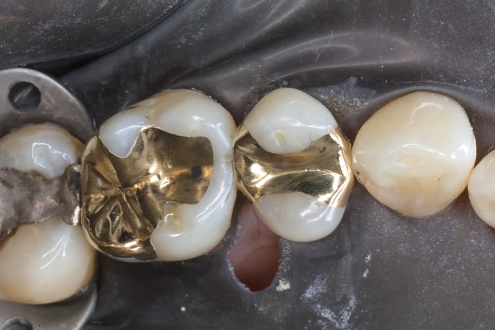 Gary Umeda #13-14 finish