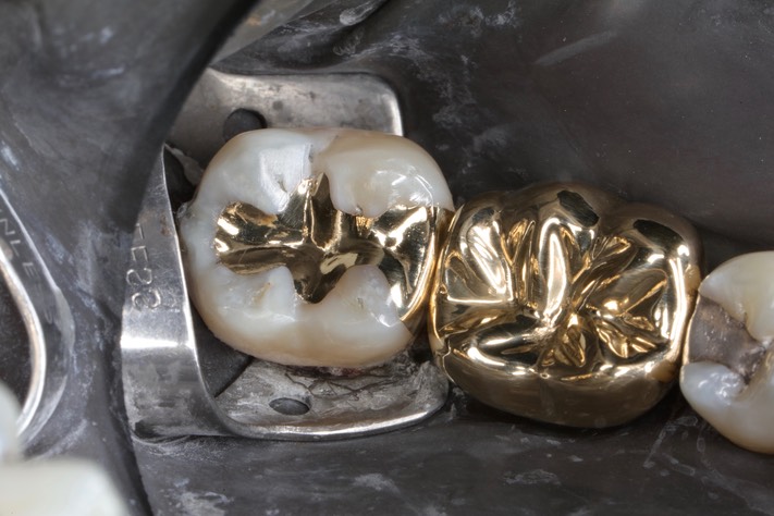 Gary Umeda #30-31 finish