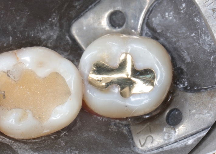 Gary Umeda #18 finish