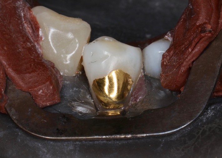 Gary Umeda #20 finish