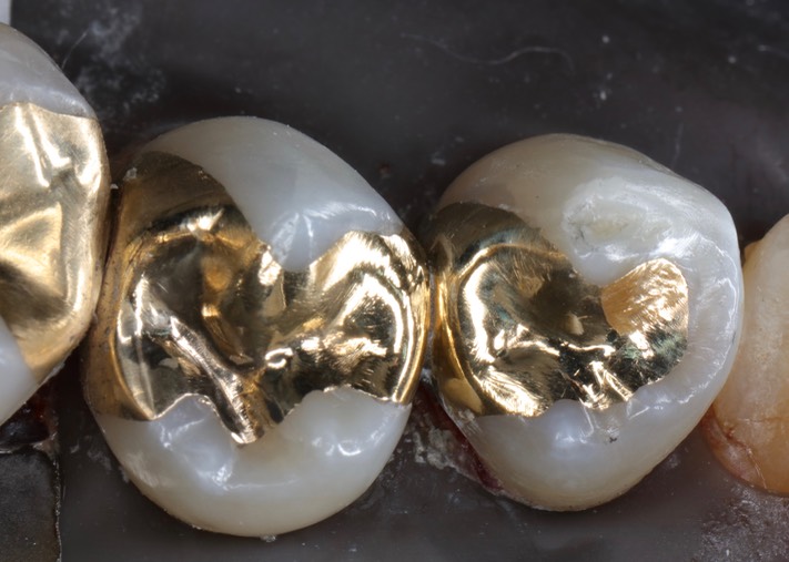 Gary Umeda #28-29 finish