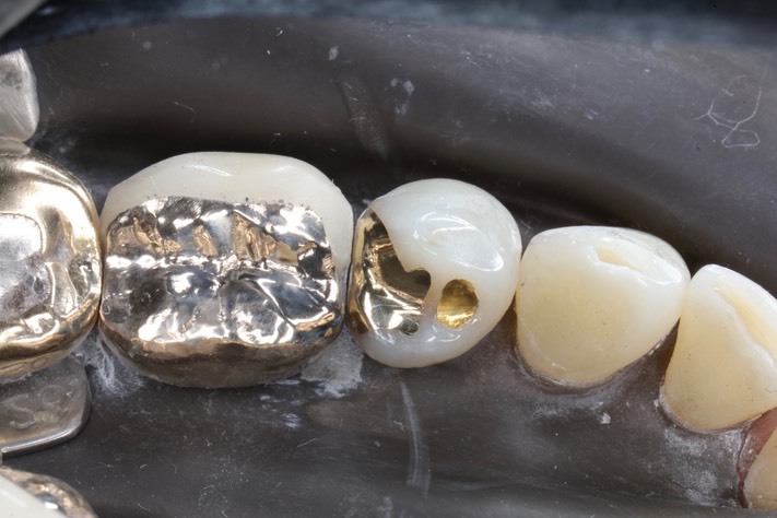 Gary Umeda #28 finish