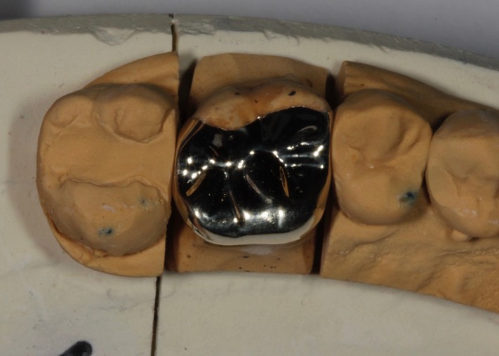 Gary Umeda #3 casting on model