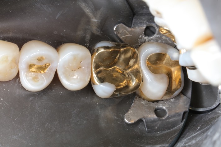 Gary Umeda #3 finish