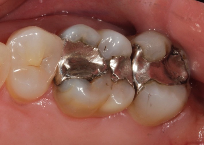 Gary Umeda #3 pre-op