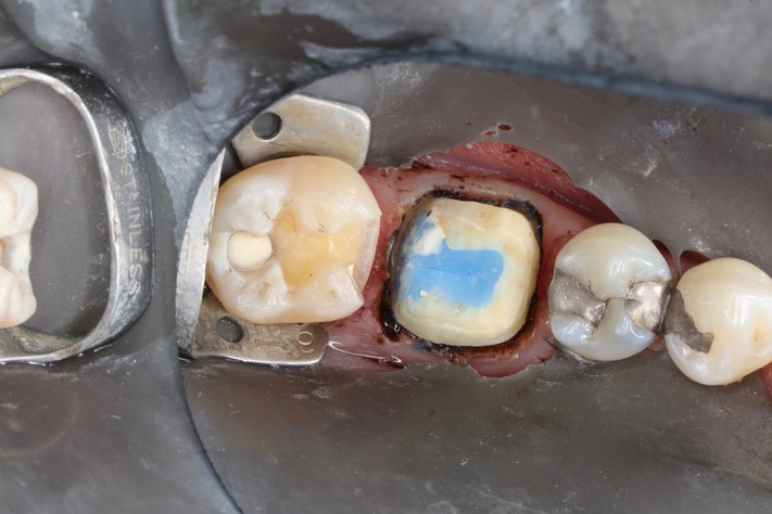 Gary Umeda #30 - 31 prep