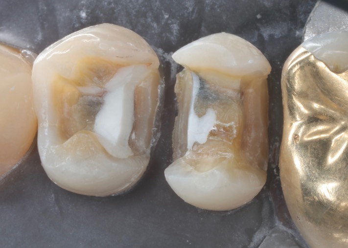 Gary Umeda #4 & 5 prep