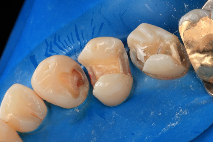 Gary Umeda #4,5,6 prep