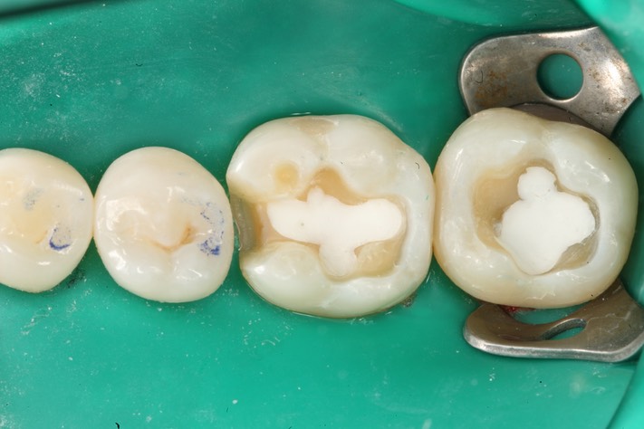 Ted Kanamori #18-19 prep