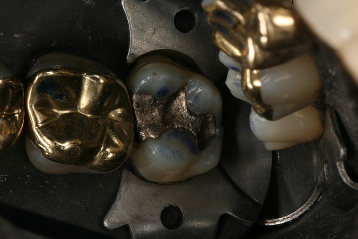 Russ Tabata #2 pre-op