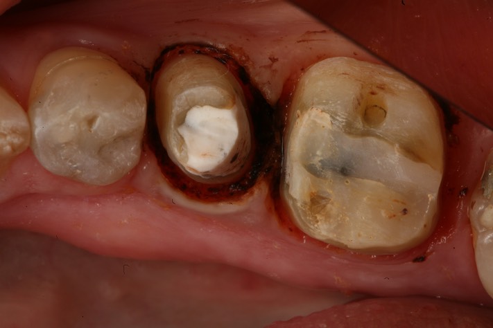 Gary Umeda #19-20 prep