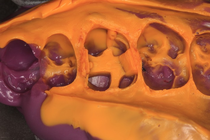 Mark Chun #3 impression