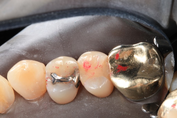 Russ Tabata #4 pre-op