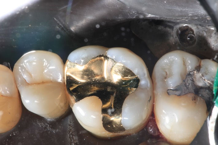 Mendel Sato #3 finish