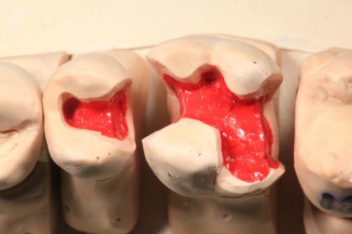 Larry Fujioka #13-14 model