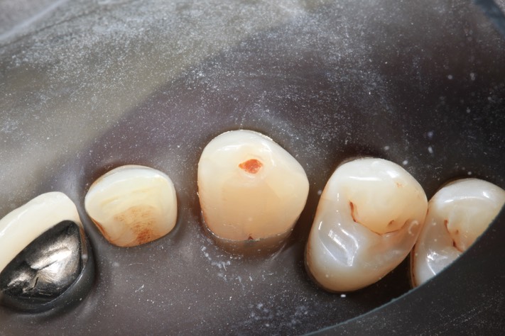 Larry Fujioka #6 pre-op