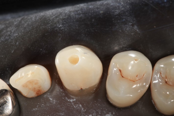 Larry Fujioka #6 prep