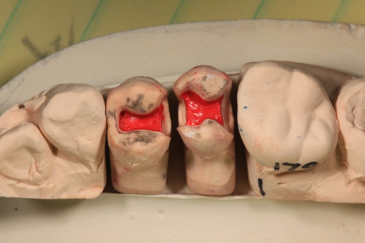 Kyle Chock #12-13 model