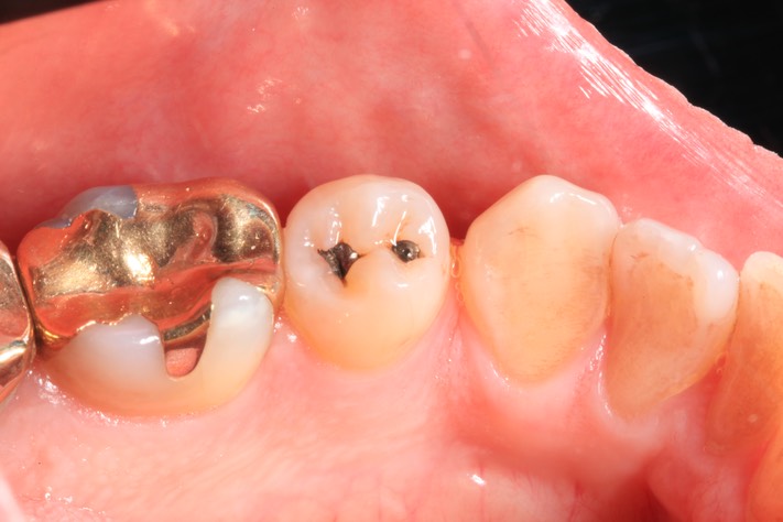 Mark Chun #29 pre-op