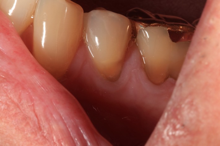 Ted Kanamori #20 pre-op