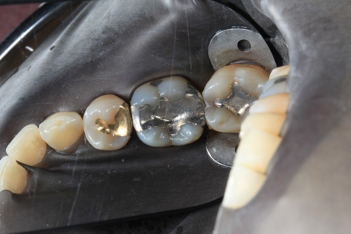 Wayne Chin #19 pre-op