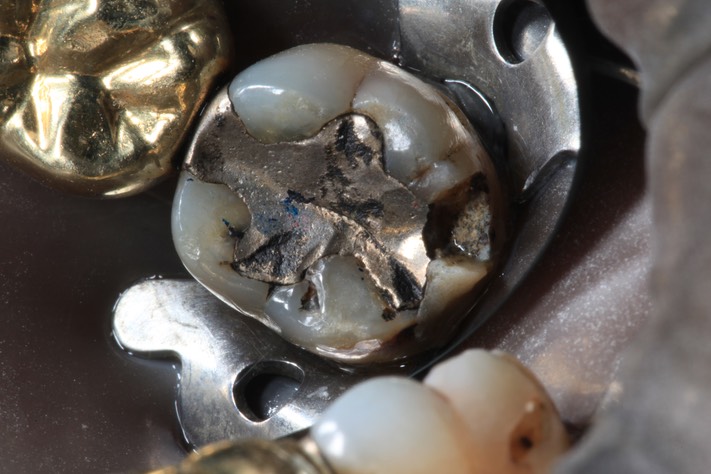 Alan Tamashiro #18 pre-op