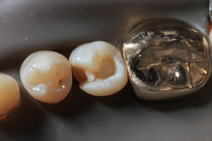 Larry Fujioka #20 prep