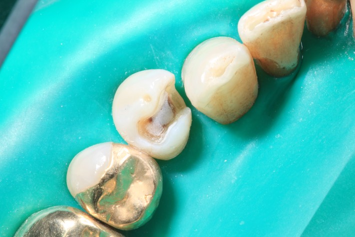 Scott Kanamori #28 prep