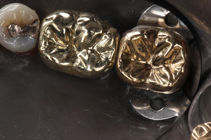 Alan Tamashiro #18 finish