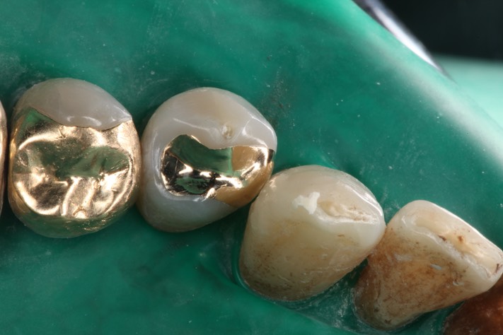 Scott Kanamori #28 finish