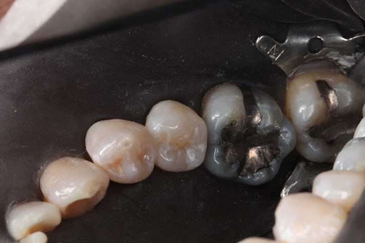 Frank Fukuda #19 pre-op